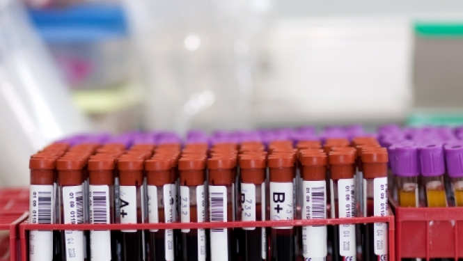 Palielinājies slimnīcu pieprasījums pēc asins komponentiem, VADC lūdz asinsdonoru palīdzību