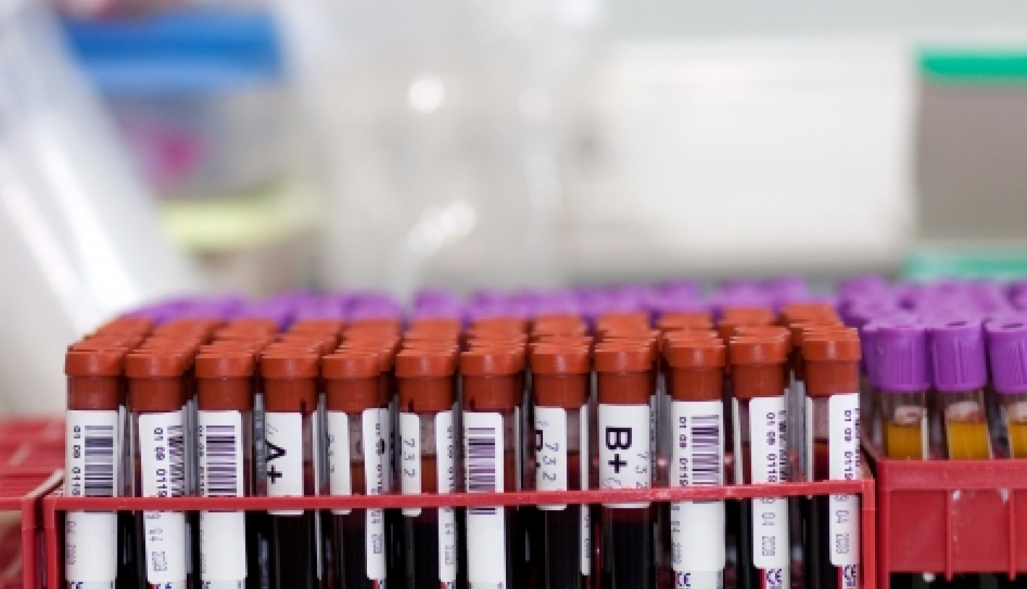 Palielinājies slimnīcu pieprasījums pēc asins komponentiem, VADC lūdz asinsdonoru palīdzību